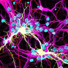 An image of fused neurons in yellow, expressing Spike S fusogen from the SARS-CoV-2 virus and the human receptor hACE2.